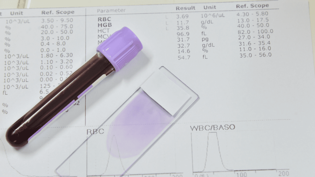 Domine O Hemograma Curso De Hematologia Laboratorial